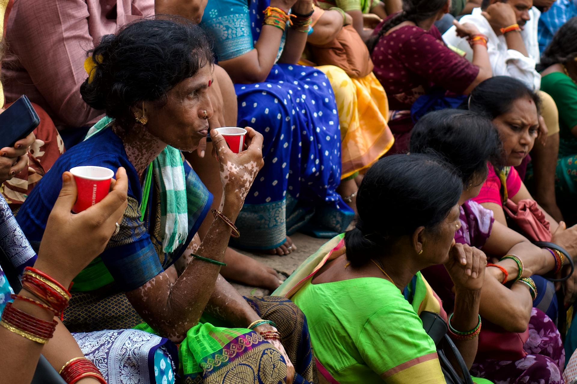 Autoimmune diseases like lupus and vitiligo are fairly common in Indian women