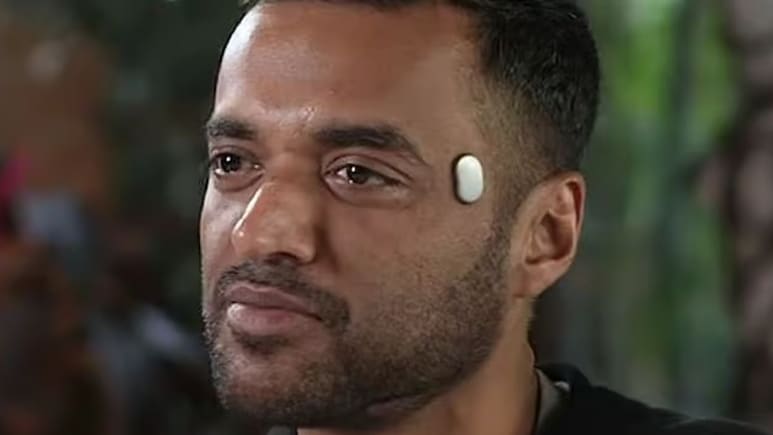 Zomato CEO दीपिंदर गोयल के माथे पर दिखा रहस्यमयी डिवाइस, जानिए क्या है इसमें खास