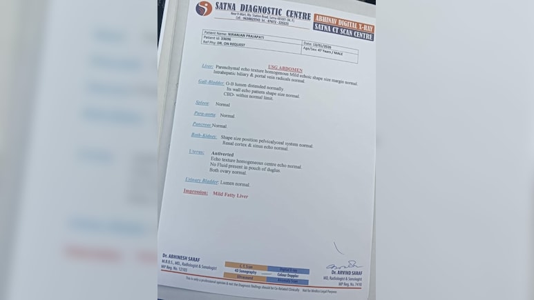 Man With A Uterus? Satna Sonography Delivers Diagnosis That Defies Science