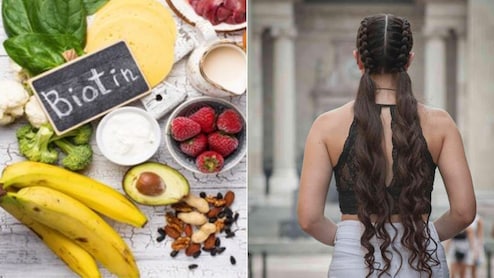 Biotin for Hair Growth: क्या बायोटिन से सच में बाल बढ़ते हैं? जानें Biotin लेने से बालों पर कैसा असर होता है