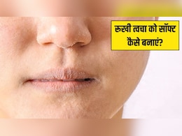 सर्दियों में स्किन बहुत ज्यादा ड्राई हो जाए तो क्या करें? डाइटीशियन ने बताया कैसे सॉफ्ट रहेगी खिंची-खिंची त्वचा