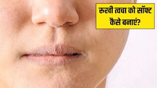 सर्दियों में स्किन बहुत ज्यादा ड्राई हो जाए तो क्या करें? डाइटीशियन ने बताया कैसे सॉफ्ट रहेगी खिंची-खिंची त्वचा