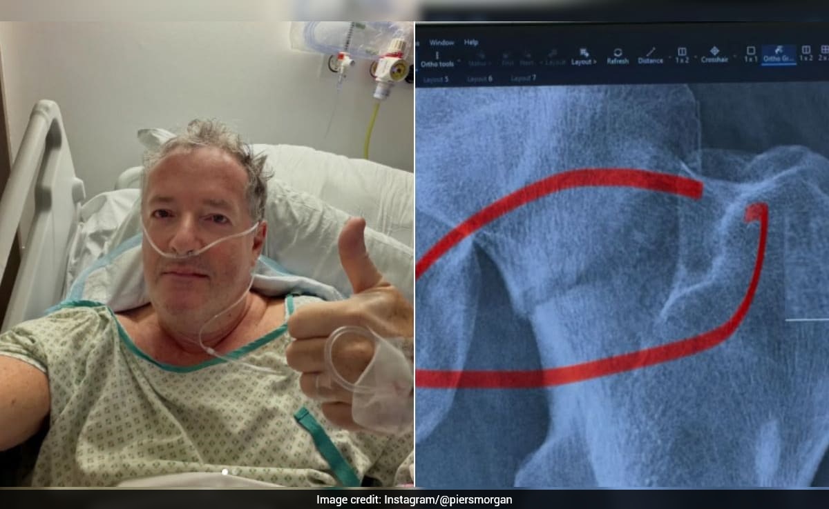"Needed New Hip": Piers Morgan Shares Health Update From Hospital After Nasty Fall