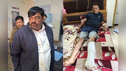 आधी रात में पुलिस पर पथराव, आरक्षक घायल; अवैध परिवहन को रोकने पहुंची थी टीम
