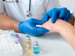 7 Signs And Symptoms Of A Skin Infection