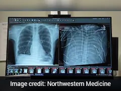 Man Miraculously Survives 48 Hours Without Lungs Before Transplant