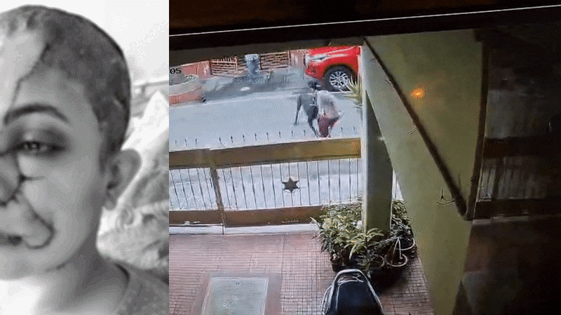 चेहरे पर इतने टांके कि रूह कांप रही... मॉर्निंग वॉक पर गई महिला को पालतू कुत्ते ने बुरी तरह नोंच डाला Video