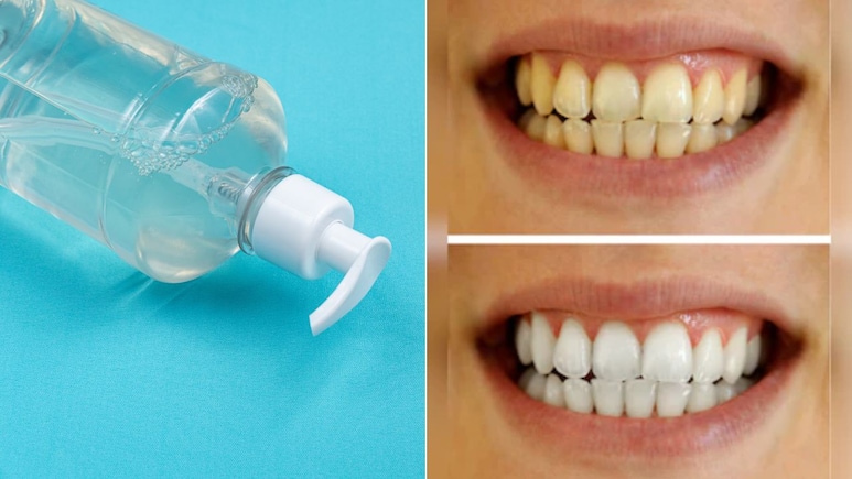 घर पर माउथवॉश कैसे बनाएं? इससे कुल्ला करने पर दूर हो जाएगी मुंह से बदबू और पीले दांतों की दिक्कत