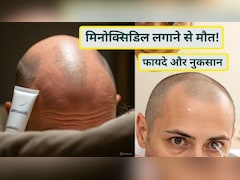 मिनोक्सिडिल लगाने से मौत! जानें Minoxidil कैसे काम करता है, इसके फायदे और नुक्सान