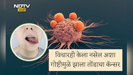 Oral Cancer: ना सिगारेट-बिडी ना तंबाखूचं व्यसन; तरीही 21 वर्षाचा तरुण ओरल कॅन्सरने ग्रस्त, कारण ऐकून भरेल धडकी