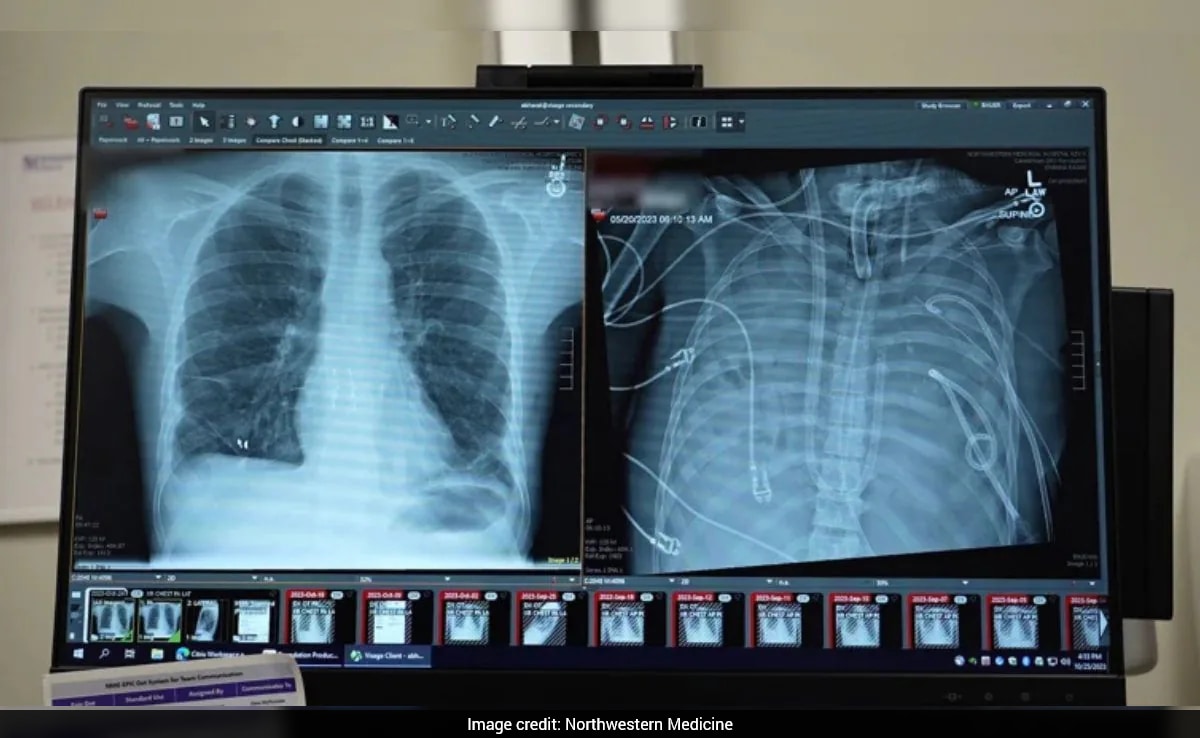 Man Survives 48 Hours Without Lungs