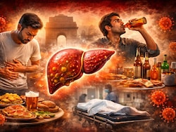 Think Your Monthly Alcohol Binge Is Fine? Study Says It Triples Your Risk Of Liver Damage