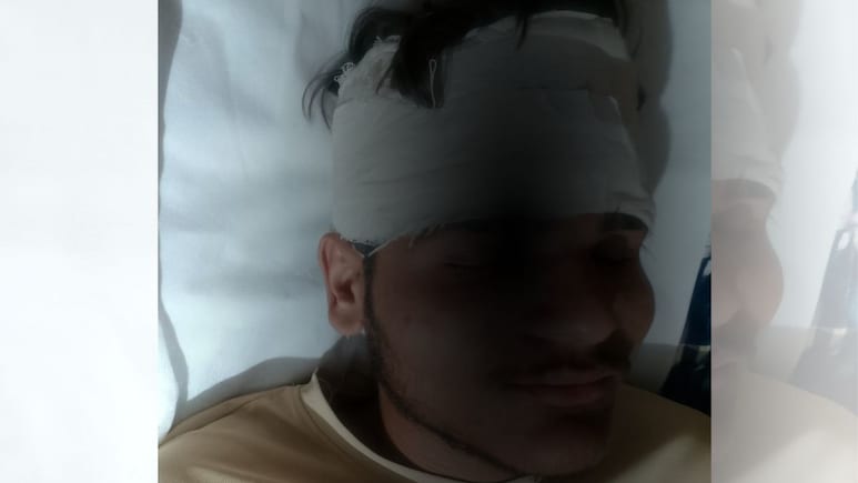 जोधपुर के सरकारी स्कूल में खूनी खेल, बहन पर टिप्पणी को लेकर छात्रों में हुई झड़प... सिर पर गंभीर चोट