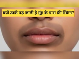 होंठों के आसपास का कालापन कैसे दूर करें? स्किन की डॉक्टर ने बताई क्यों डार्क पड़ जाती है मुंह के पास की स्किन