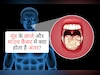 सावधान! अगर 2 हफ्ते से ज्यादा रहता है मुंह का छाला, तो ये मामूली बात नहीं, जानें कैंसर और छालों में फर्क