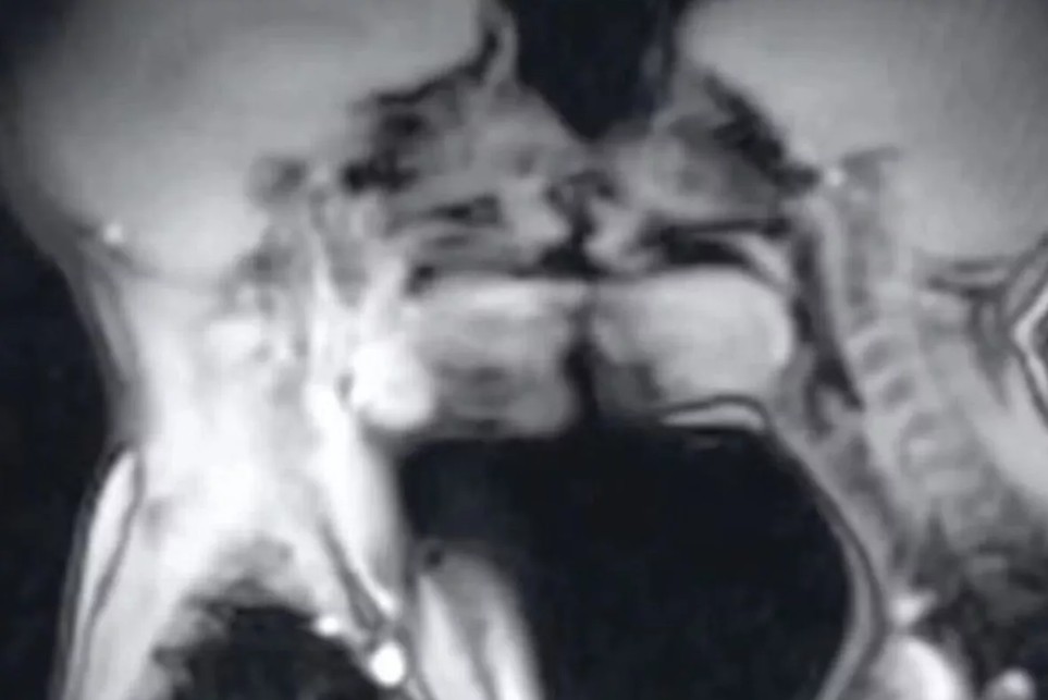 MRI मशीन में कपल का सेक्स, 30 साल पहले हुआ साइंस एक्सपेरिमेंट, बदल गई मेडिकल हिस्ट्री