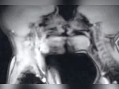 MRI मशीन में कपल का सेक्स, 30 साल पहले हुआ साइंस एक्सपेरिमेंट, बदल गई मेडिकल हिस्ट्री