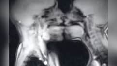 MRI मशीन में कपल का सेक्स, 30 साल पहले हुआ साइंस एक्सपेरिमेंट, बदल गई मेडिकल हिस्ट्री