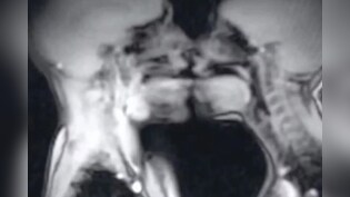 MRI मशीन में कपल का सेक्स, 30 साल पहले हुआ साइंस एक्सपेरिमेंट, बदल गई मेडिकल हिस्ट्री