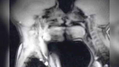MRI मशीन में कपल का सेक्स, 30 साल पहले हुआ साइंस एक्सपेरिमेंट, बदल गई मेडिकल हिस्ट्री