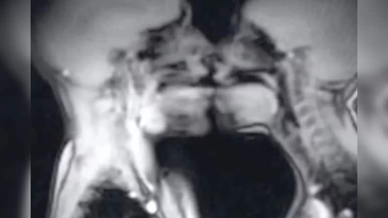 MRI मशीन में कपल का सेक्स, 30 साल पहले हुआ साइंस एक्सपेरिमेंट, बदल गई मेडिकल हिस्ट्री