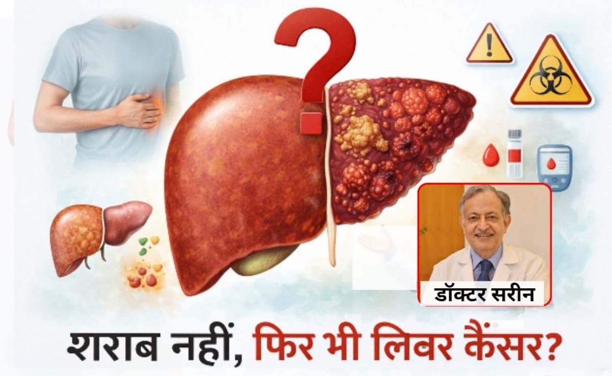शराब नहीं पीते, फिर भी लिवर कैंसर का खतरा, 50 साल अनुभव वाले लिवर स्पेशलिस्ट ने बताई वजह