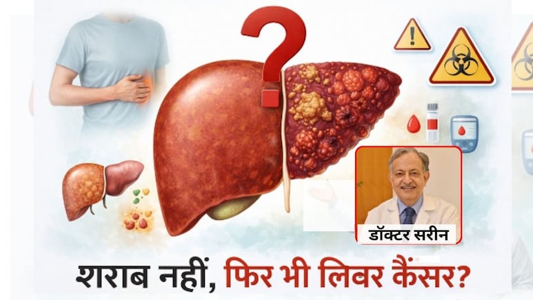 शराब नहीं पीते, फिर भी लिवर कैंसर का खतरा, 50 साल अनुभव वाले लिवर स्पेशलिस्ट डॉ. सरीन ने बताया असली कारण