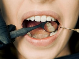 Your Mouth Bacteria Can Predict Risk Of Chronic Liver Disease: Study