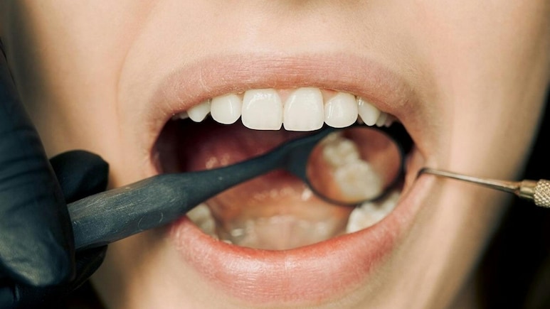 Your Mouth Bacteria Can Predict Risk Of Chronic Liver Disease: Study