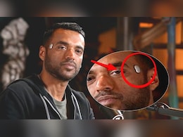 महामानव बन रहे जोमैटो के CEO, दीपिंदर गोयल की कनपटी पर लगा ये डिवाइस क्या है?