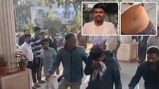 किसान की आपबीती से खुली किडनी कांड की काली कहानी, दिल्ली से कंबोडिया तक जुड़े तार, 16 गरीबों को बना चुके शिकार