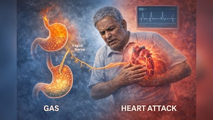दाल खाने से हुई गैस, हार्ट अटैक से मौत, क्या पेट की गैस Heart Attack का खतरा बढ़ा सकती है? जानें डॉक्टर की राय