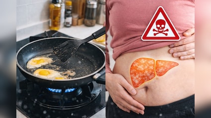 आपके किचन का नॉन-स्टिक बर्तन बन सकता है बच्चों के लिवर का दुश्मन, चौंकाने वाली स्टडी में बड़ा खुलासा