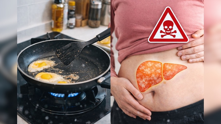 आपके किचन का नॉन-स्टिक बर्तन बन सकता है बच्चों के लिवर का दुश्मन, चौंकाने वाली स्टडी में बड़ा खुलासा