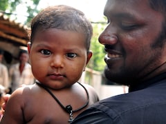 25 Districts In Gujarat Bring Leprosy Cases Below Elimination Threshold