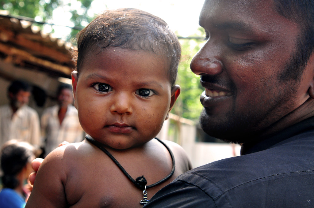 25 Districts In Gujarat Bring Leprosy Cases Below Elimination Threshold