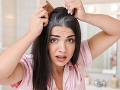 White Hair Causes: मेरे बाल सफेद क्यों हो रहे हैं, जानिए इसके पीछे के बड़े कारण