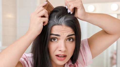 White Hair Causes: मेरे बाल सफेद क्यों हो रहे हैं, जानिए इसके पीछे के बड़े कारण