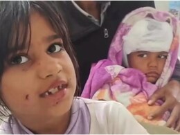 हिम्मत हो तो ऐसी... छोटे भाई को बचाने के लिए कुत्ते से भिड़ गई आठ साल की बहन, लिजा की बहादुरी की कहानी