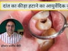 डॉक्टर ने बताया दांत में कीड़ा, दर्द और सड़न का असरदार आयुर्वेदिक नुस्खा, बस घर पर इस चीज से बनाएं माउथ वॉश