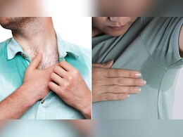 बहुत ज्यादा पसीना आता है तो क्या करें? जानें शरीर से ज्यादा पसीना आना कैसे रोकें