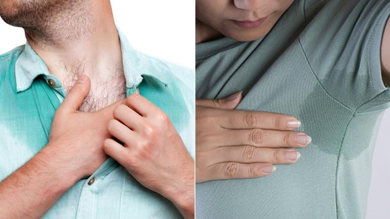 बहुत ज्यादा पसीना आता है तो क्या करें? जानें शरीर से ज्यादा पसीना आना कैसे रोकें