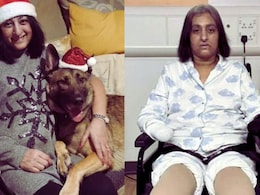 पाळीव कुत्र्याने प्रेमाने चाटलं अन् महिलेने गमावले हात-पाय; उपचारादरम्यान 6 वेळा हृदयविकाराचा झटका