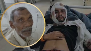 बेटे के इलाज के बदले पिता का मोबाइल गिरवी! रोड एक्&zwj;सीडेंट के बाद MP में सामने आई दर्दनाक कहानी