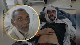 बेटे के इलाज के बदले पिता का मोबाइल गिरवी! रोड एक्&zwj;सीडेंट के बाद MP में सामने आई दर्दनाक कहानी