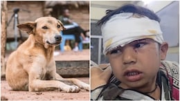 राजस्थान में 4 साल के बच्चे को कुत्ते ने अपने जबड़े में दबाकर 100 मीटर तक घसीटा, अलवर रेफर