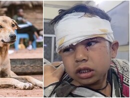 राजस्थान में 4 साल के बच्चे को कुत्ते ने अपने जबड़े में दबाकर 100 मीटर तक घसीटा, अलवर रेफर