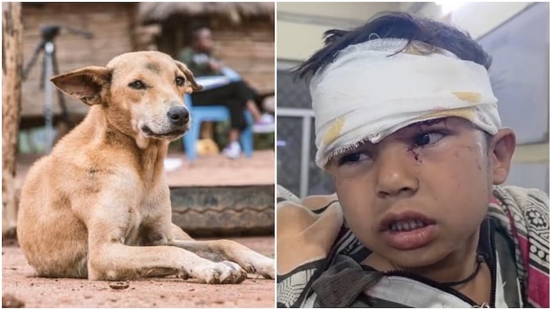 राजस्थान में 4 साल के बच्चे को कुत्ते ने अपने जबड़े में दबाकर 100 मीटर तक घसीटा, अलवर रेफर