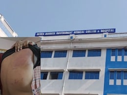 Student Assaulted, Massive Bruises On Back In Bengal Medical College Ragging