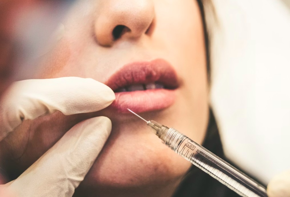 US Women Are Getting Fat Injected From Dead Bodies To Get Perfect Figure